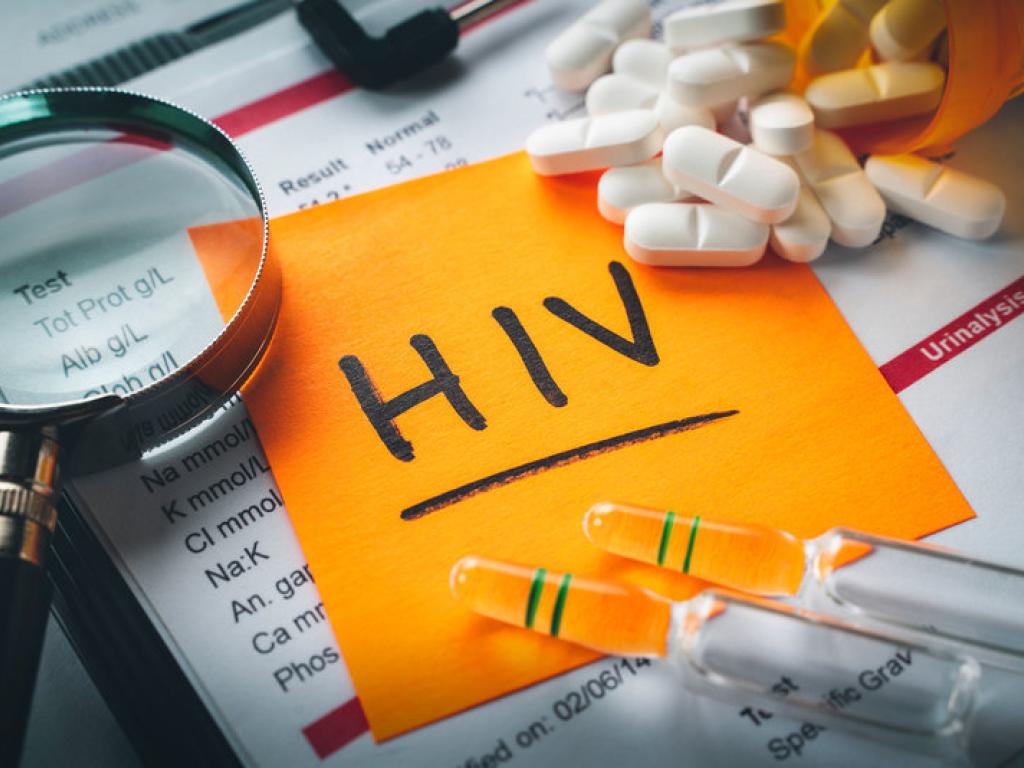 HIV