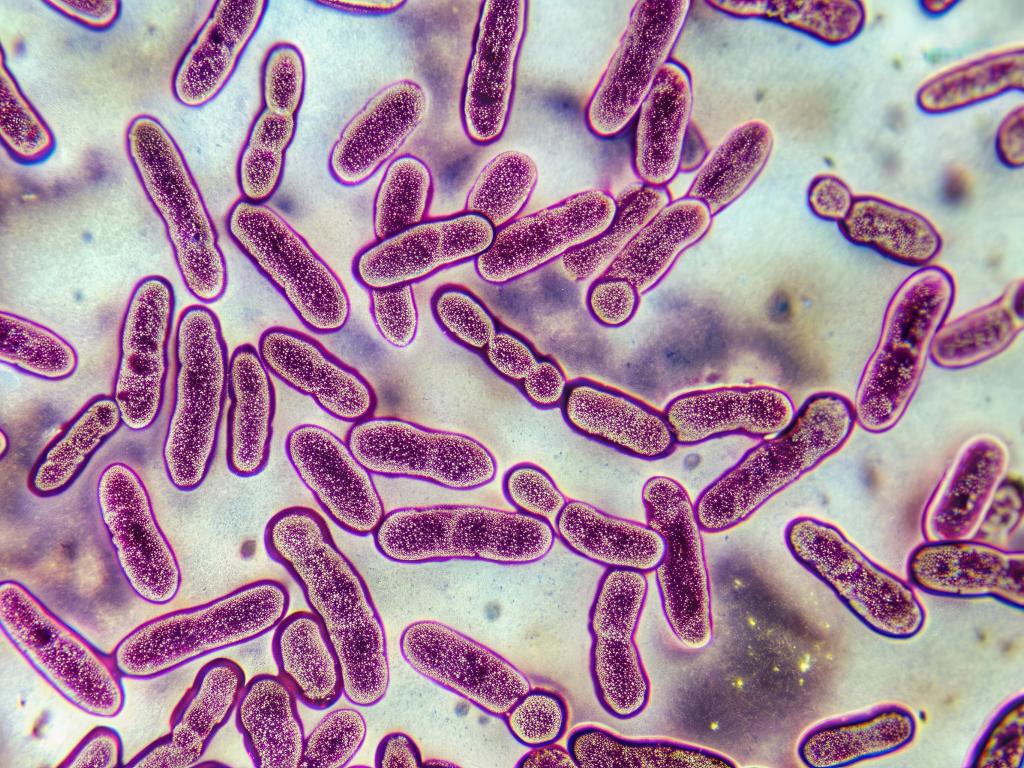 MTB cells
