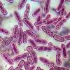 Mycobacterium tuberculosis bacteria colonies